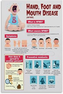 Hand Foot Mouth Disease Poster Medical Knowledge Poster (5) Canvas Painting for Living Room Bedroom Decor 08x12inch(20x30cm) Unframe-style