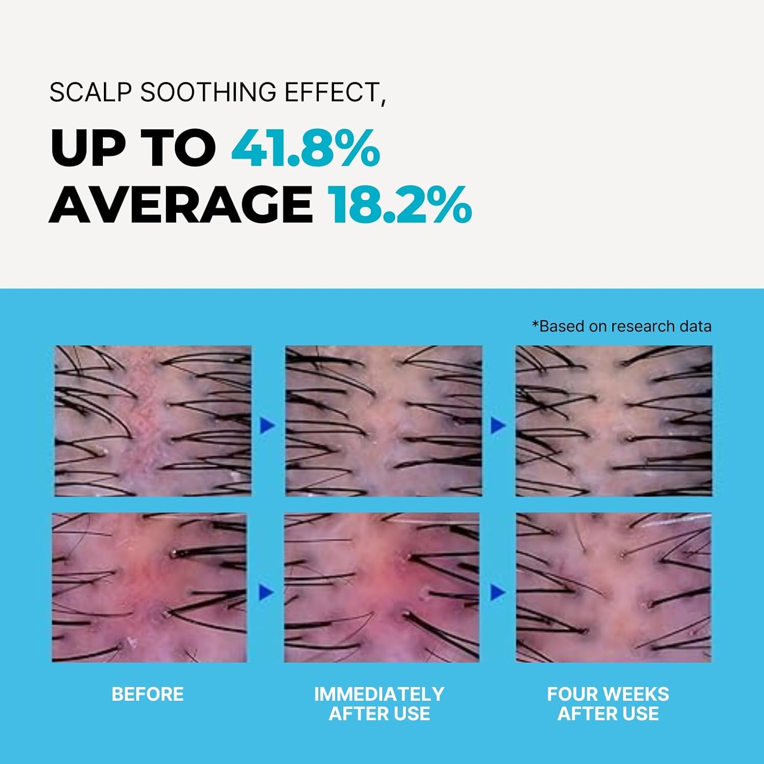 Chlorine Removing Shampoo for Swimmers | Vitamin C | Clarifying & Hydrating | Free of Sulfates, Silicones, Parabens (10.58 oz / 300g, Pack of 1) - Image 4