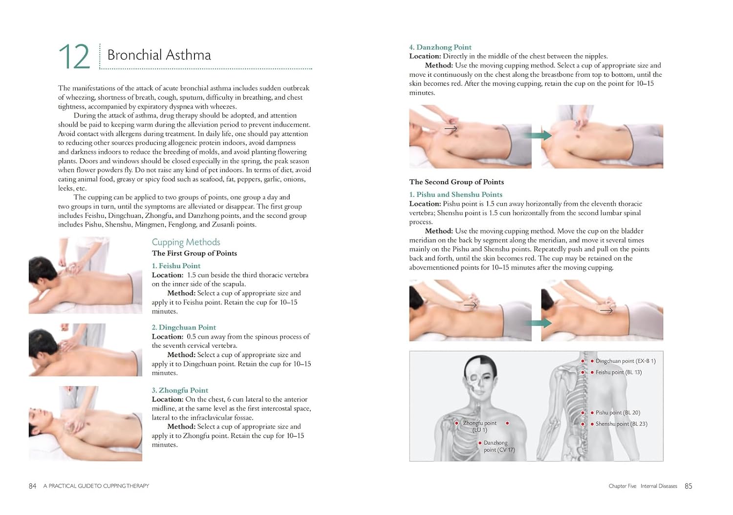 Practical Guide to Cupping Therapy: A Natural Approach to Heal Through Traditional Chinese Medicine