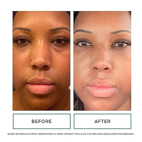 Miniatura 5 de Replenix Crema triple AOX que reduce el enrojecimiento, tratamiento facial antioxidante hidratante de grado médico con té verde calmante para pieles
