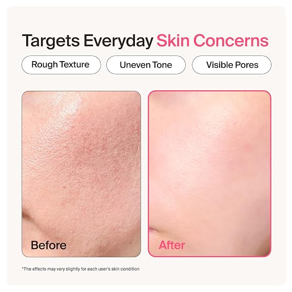 Meebak Camellia Serum, Exfoliant, Pore Minimizer and Wrinkle Care