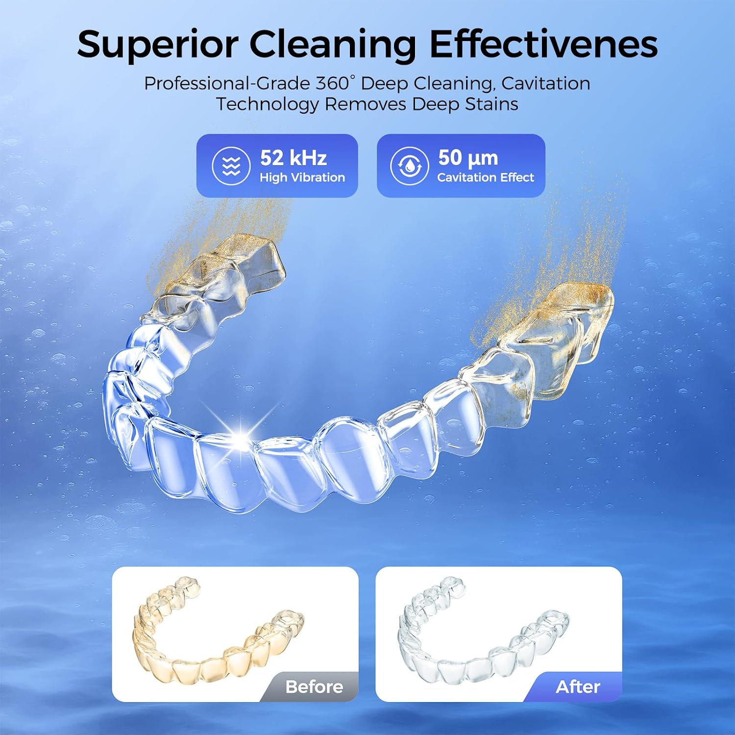 CALOTO Ultrasonic Retainer Cleaner Machine, 52kHz Ultrasonic Denture Cleaner for Night Guards, Braces, Aligner, Toothbrush, Jewelry and More, Dental Cleaning Pod with Digital Timer & 250ML, Black