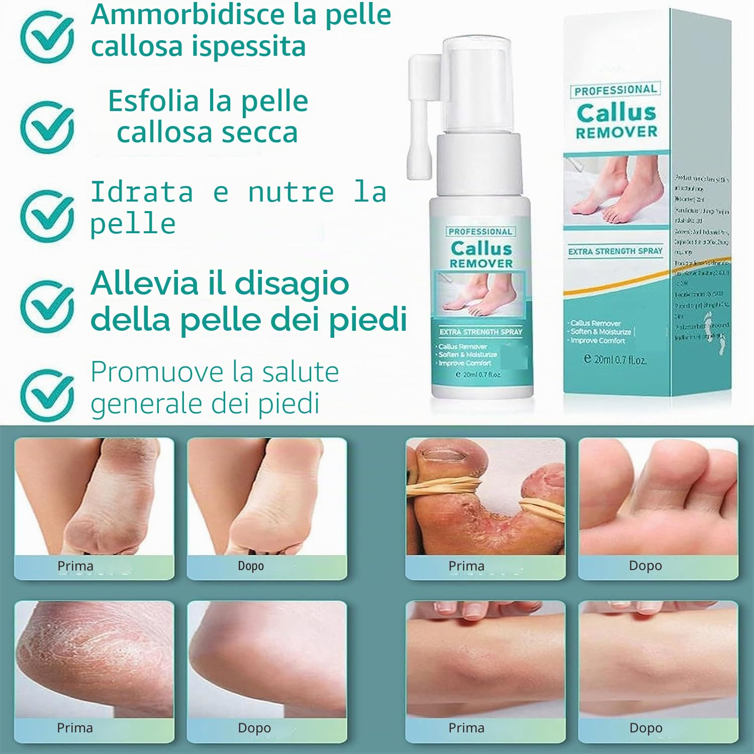 Spray extra forte per rimuovere i calli: spray rimuovi calli per piedi e tallone, olio spray per pelle morta