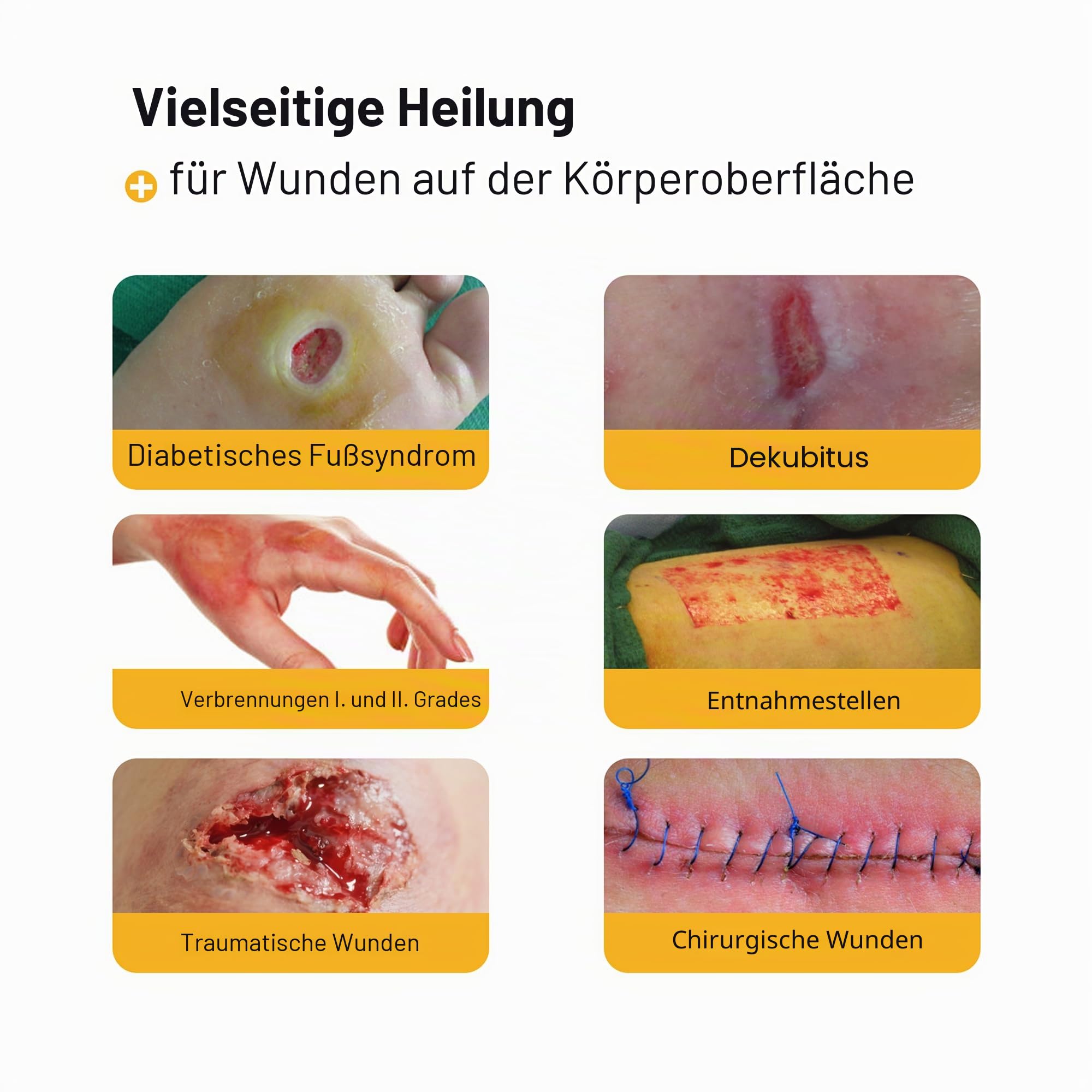 AWD Manuka-Honiggaze-Verband – 100 % imprägnierte medizinische Honigpflaster – Medizinbedarf, Wundpflege und Erste Hilfe – Mullpads (5,1 x 5,1 cm, 10 Stück)