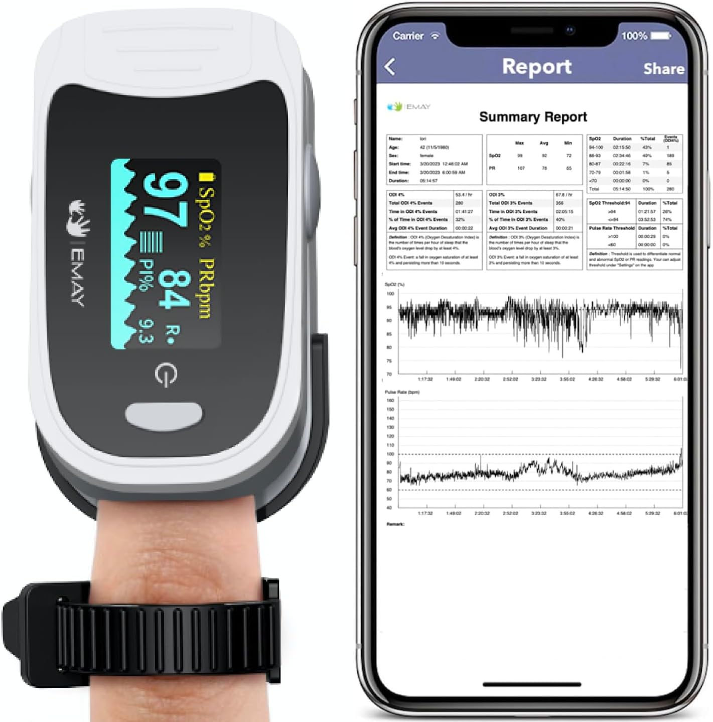 Sleep Pulse Oximeter with Built-in Recording Capability | Record Continuous Blood Oxygen Levels & Pulse Rate Overnight | Provides Sleep Report & Raw Data