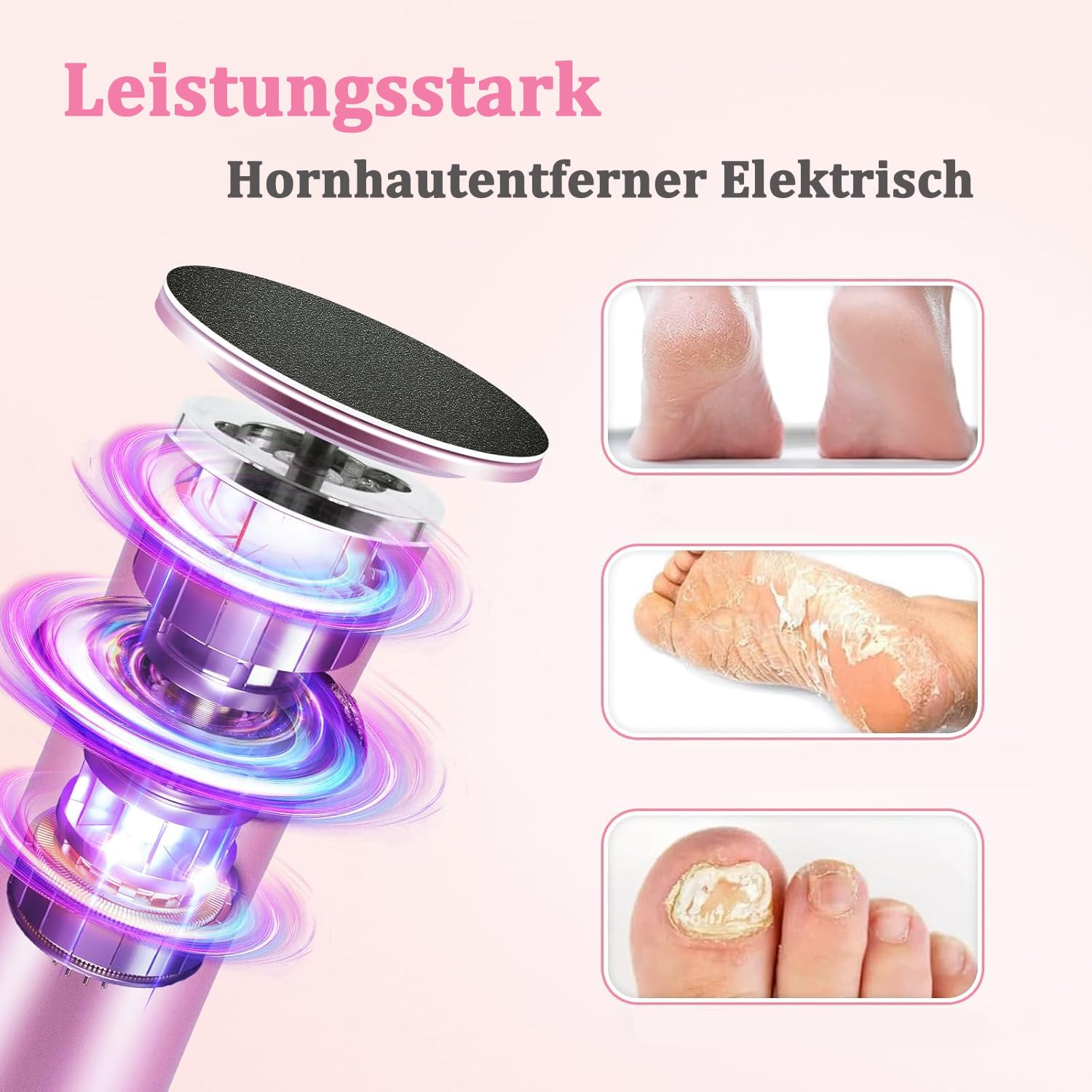 Dermaglide Hornhaut Entferner, DermaGlide Pro, Hornhautentferner Elektrisch mit 60 Schleifpapierscheiben, für Abgestorbene Haut, Rissige Haut, Schwielen (Rosa)