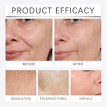 Micro Infusion System for Face, Facial Moisturizing Essence, Micro Facial System with Serum Smooth Skin Facial Serum (4x Infusion Application, 12x Serums)