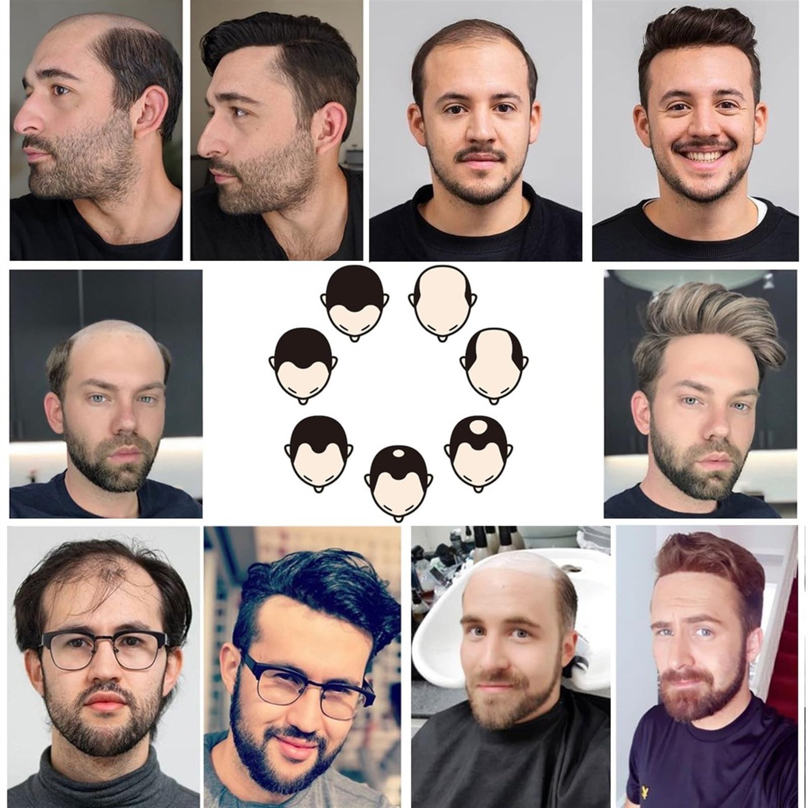 Stock De Système De Remplacement De Toupée Capillaire En Dentelle Ançaise D'Hollywood Pour Hommes New Times Hair