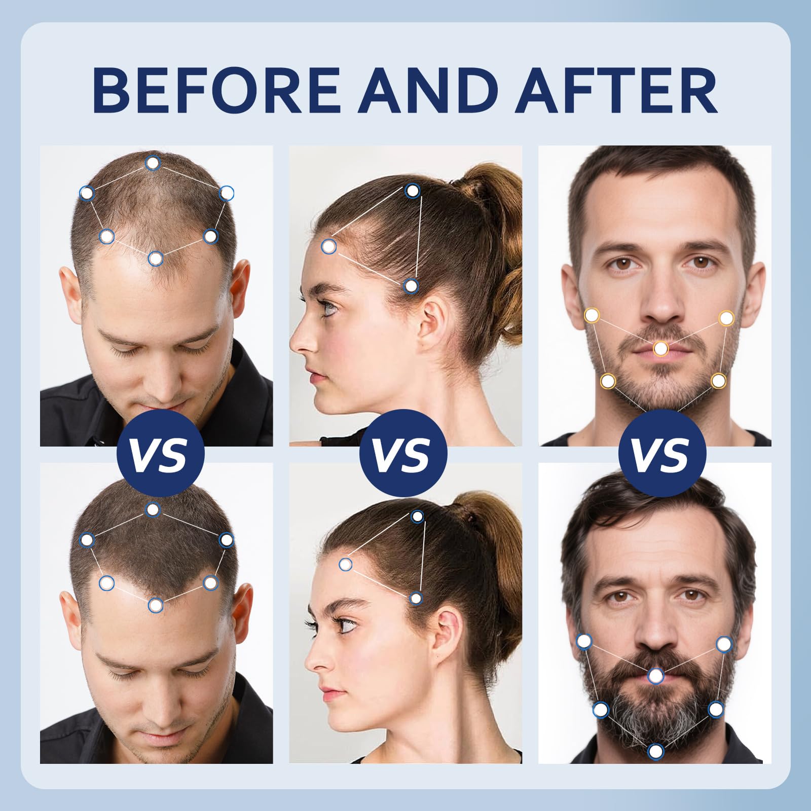 5% Minoxidil Hair Growth Serum with Biotin, Collagen & Castor Oil