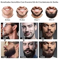 Vista 6 de Kit de crecimiento de barba, aceite de crecimiento de barba mejorado (2 onzas) con 3 biotinas espesantes y aceite de ricino para barba