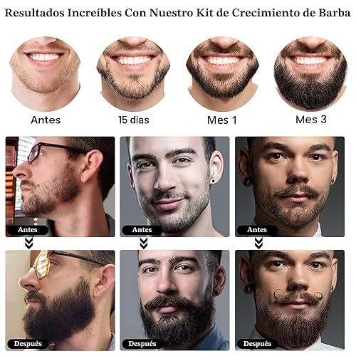 Miniatura 6 de Kit de crecimiento de barba, aceite de crecimiento de barba mejorado (2 onzas) con 3 biotinas espesantes y aceite de ricino para barba
