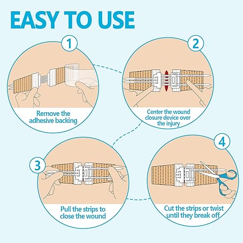 Miniatura 4 de Dispositivo de cierre de heridas de emergencia kit de bandas de suturas de puntada de cremallera 4 piezas reparación de heridas sin puntadas ideal