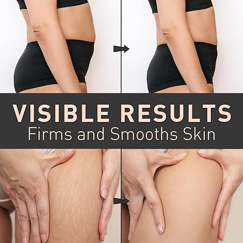 Miniatura 6 de Enaskin Naturals Crema reafirmante del vientre B Flat Skin Tightening, Celulitis y Crema Reductora de Estías para Estómago, Muslos y Botín - Loción