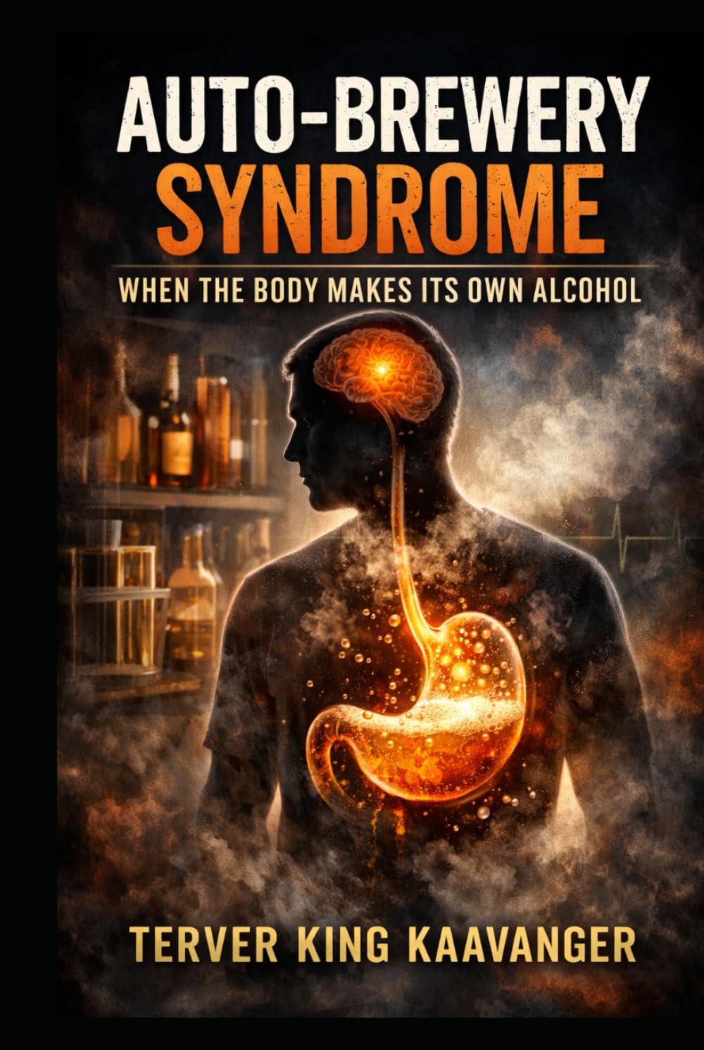 Auto-Brewery Syndrome: When the Body Makes Its Own Alcohol