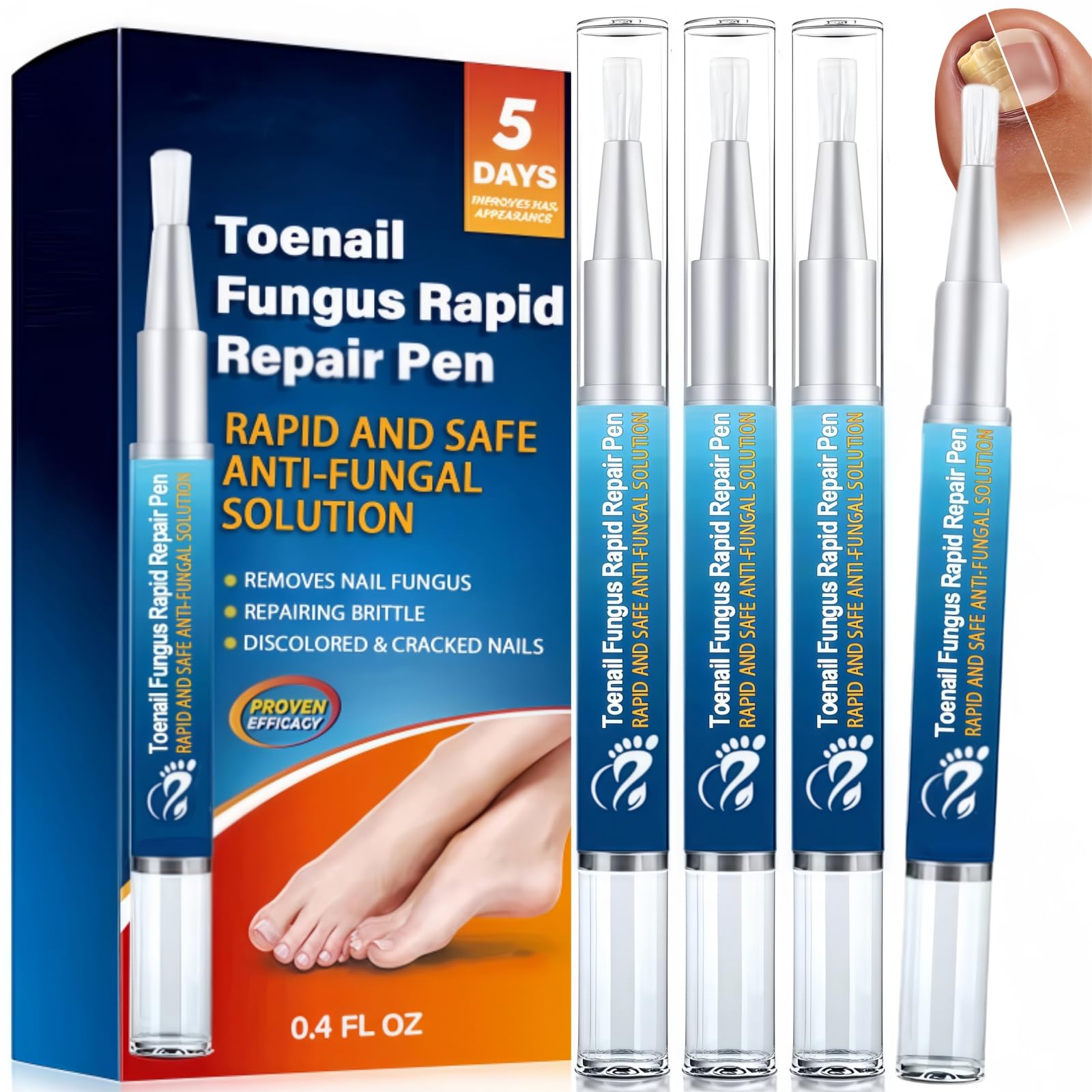 4Pcs Fungal Nail Treatment Pens, Effective Fingernai & Toenail Fungus Treatment and Repair Essence