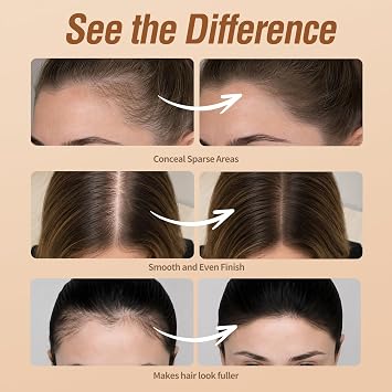 Sevich Hairline Powder 10g 2-Pack with Brush, Instantly Conceals Hair Loss & Thinning, 48H Waterproof Root Touch Up Powder, Natural Hair Shadow Toppers for Women & Men, 2 Box  5 Boxes,Light Brown