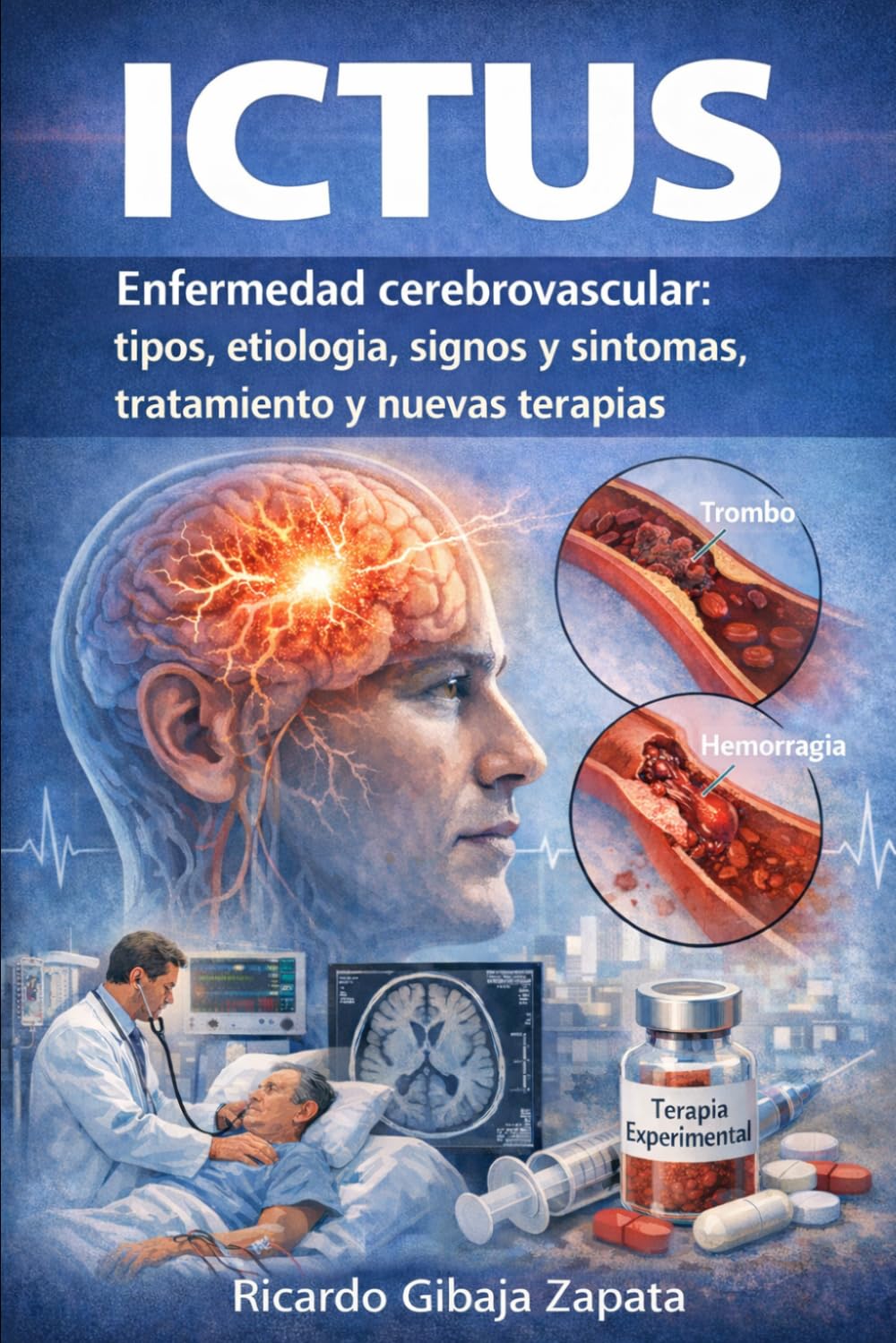 Ictus Enfermedad Cerebrovascular Fundamentos, Clínica, Diagnóstico y Tratamiento Avanzado