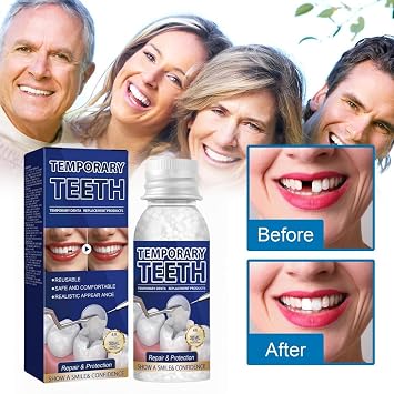 De/ntal Repair Kit,Temporary Tooth Filling,Home De/ntal Repair Kit for Repairing Lost Fillings,Tooth Filling Repair Kit for Fixing Broken,Teeth Repair & Replacement Kit,Missing Tooth Replacement Kit