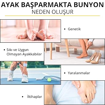 Ayak Ateli Baş Parmak Çıkıntı Düzeltici Hallux Valgus Gece Ateli Bunyon Koruyucu