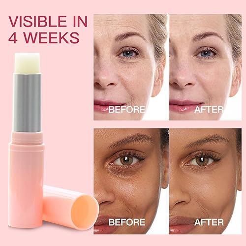 Miniatura 6 de Barra de ojos de retinol, crema de ojos de retinol con péptidos y ácido hialurónico para ojeras e hinchazón, crema para debajo de los ojos