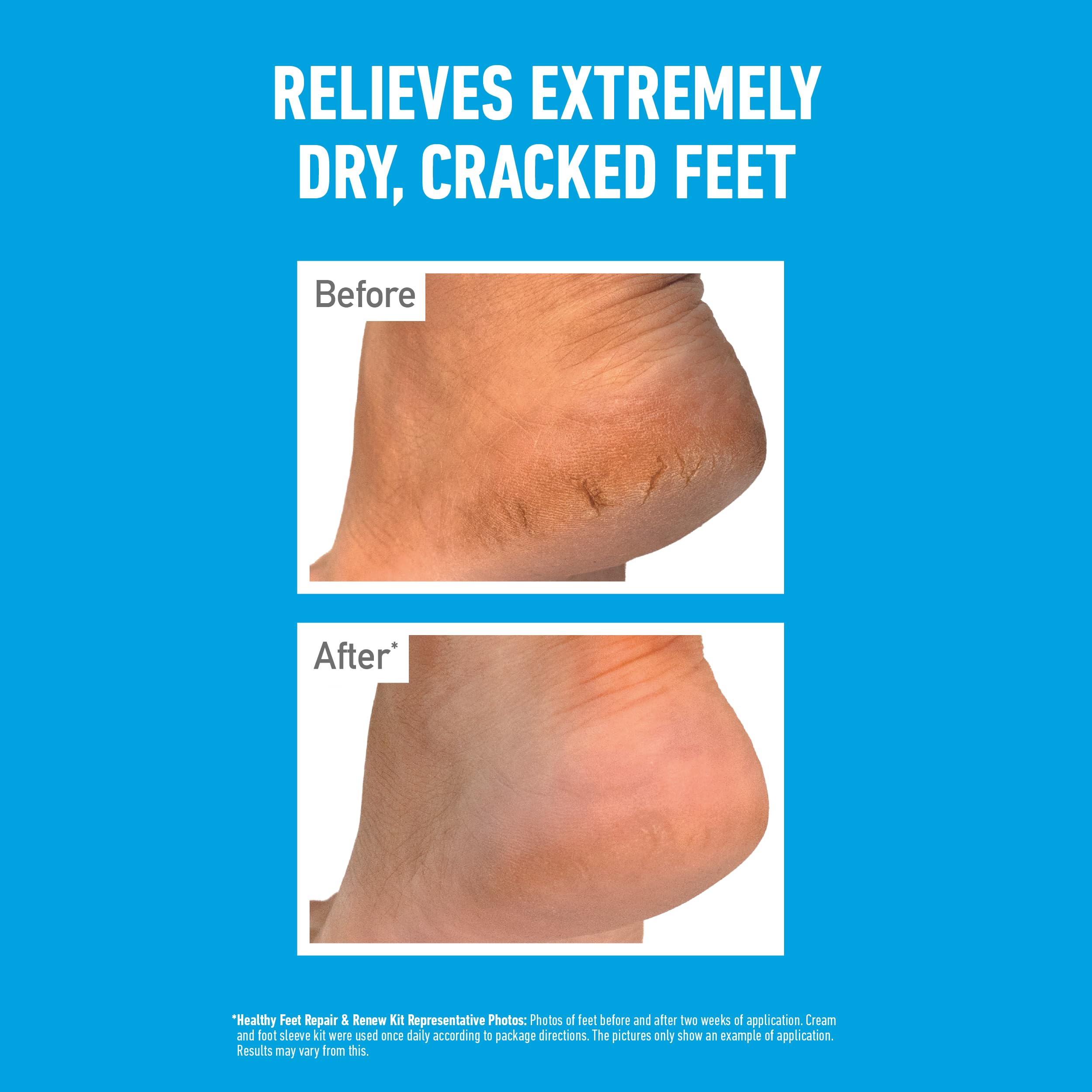 O'Keeffe's Healthy Feet Lot de 5 exfoliants pour pieds 85 g