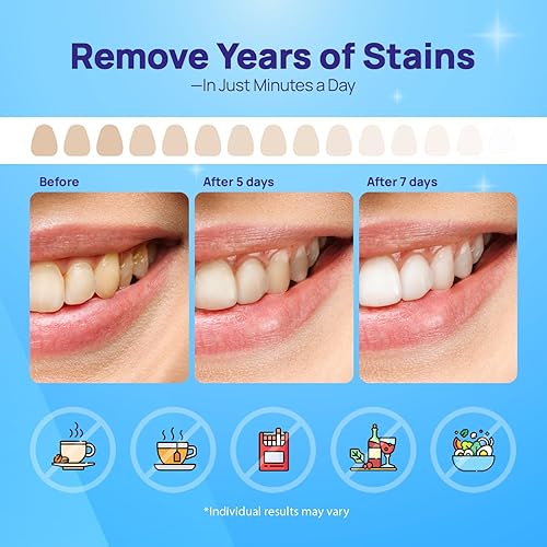 Miniatura 6 de Whitebite Pro Tiras blanqueadoras dentales con peróxido de hidrógeno, grado dentista, seguras para esmalte, antideslizantes, elimina manchas