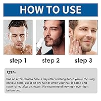 Vista 6 de React Minoxi - Tratamiento para el cabello enrollable nuevo suero para el crecimiento del cabello aceite nutritivo natural para el cuero cabelludo