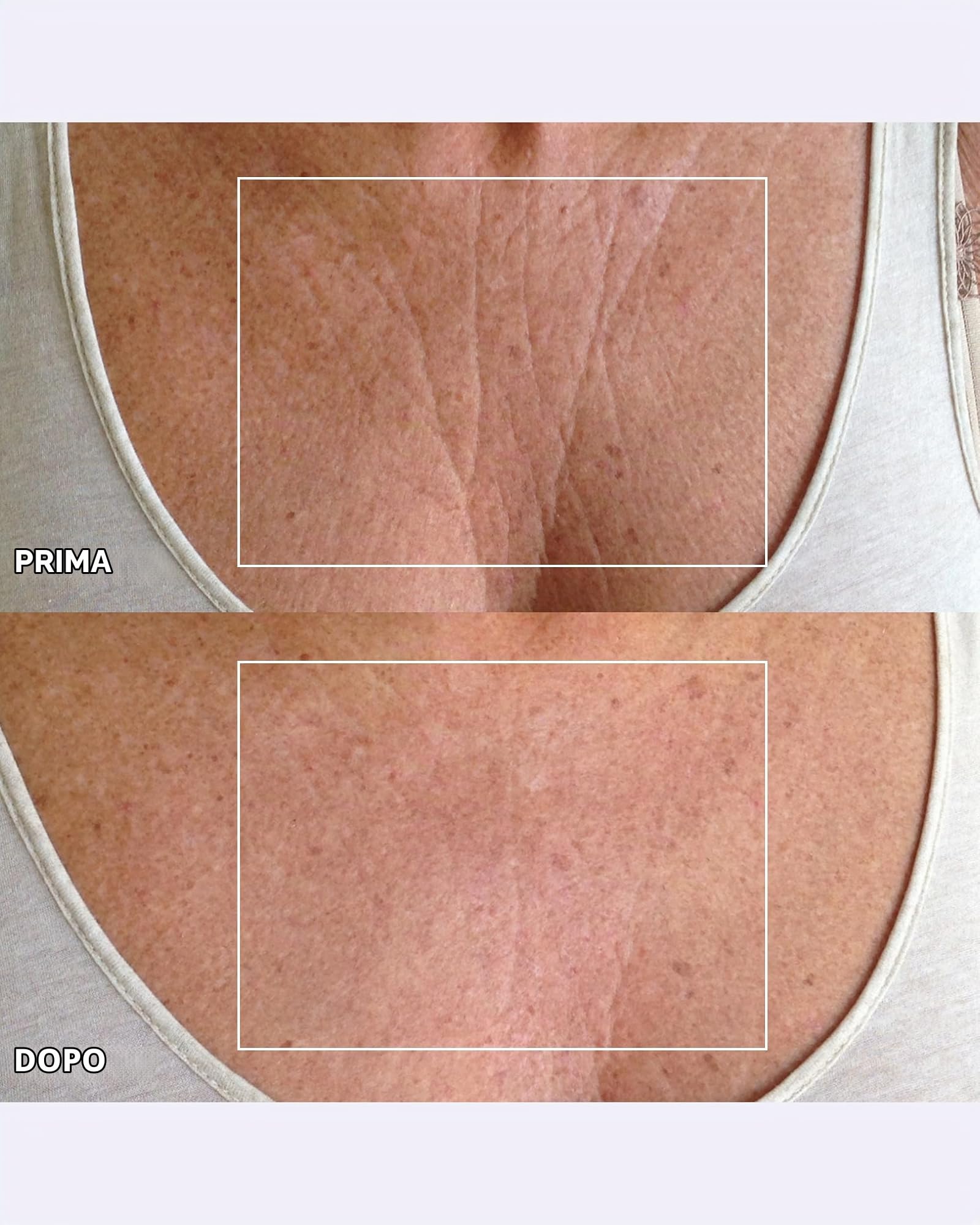 Wrinkles Schminkles - Patch antirughe per il petto, trasparenti