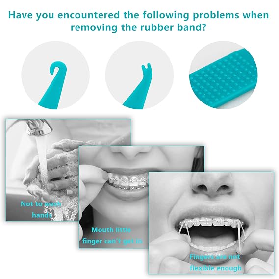 20 Pcs Dental Elastic Rubber Bands Placers for Braces, Disposable Plastic Orthodontic Elastic Placers Multi-color