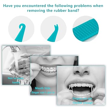 20 Pcs Dental Elastic Rubber Bands Placers for Braces, Disposable Plastic Orthodontic Elastic Placers Multi-color