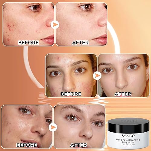 Miniatura 4 de Paquete de tiras de nariz para eliminar puntos negros 2.0 y máscara de arcilla de poros profundos, 100 tiras de poros profundos con ácido salicílico