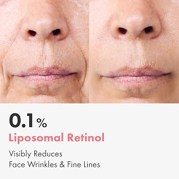 NATUREKIND Repair Retinol 0.1% Cream for Fine Lines & Wrinkles, Anti-Aging | Liposomal Retinol, Bakuchiol, Retinal, Niacinamide, Pure Vitamin A, Firming, Face & Eye, Korean Skincare, 50g/1.76 oz