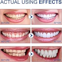 Vista 5 de Niacinamide Whitening Toothpaste, Easilyous Radiant Whitening Toothpaste,Fresh Breath,Remove Tooth Stains, 2 Pack