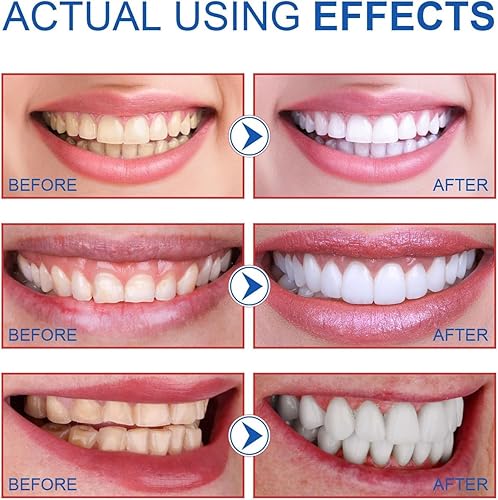 Miniatura 5 de 2PCS-SP-6 Pasta de dientes blanqueadora, blanqueamiento dental, sin esmalte, sin flúor, menta fresca, aliento fresco