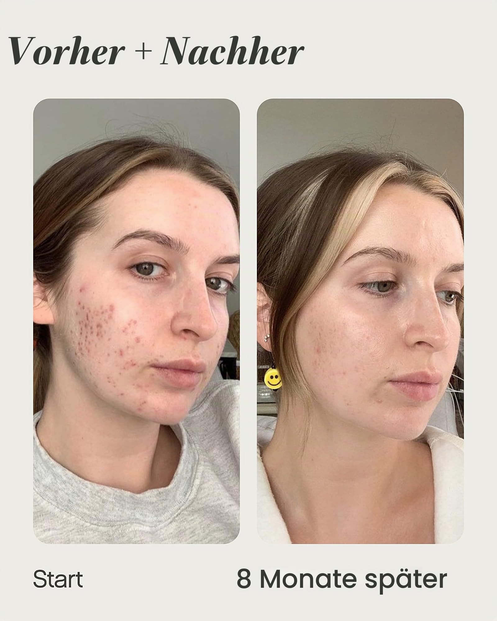 Topicals Mini-Serum für dunkle Flecken und Verfärbungen | Entfernt Flecken nach Hautunreinheiten, Narben und Flecken, Kojisäure & Niacinamid, dermatologisch getestet, vegan