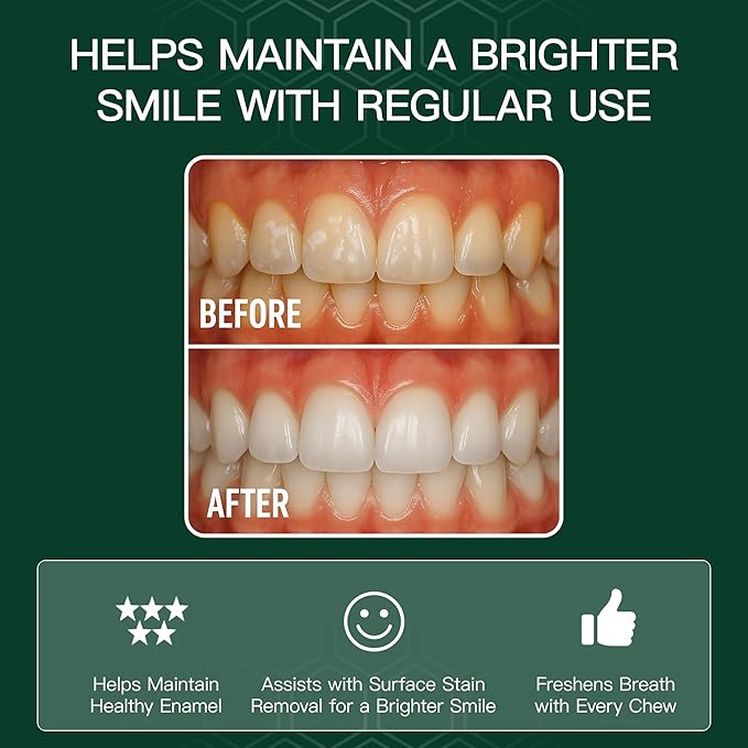 Chicle WUEIS Remineralizante con Hidroxiapatita Sabor Spearmint - 72 Unidades miniatura 2