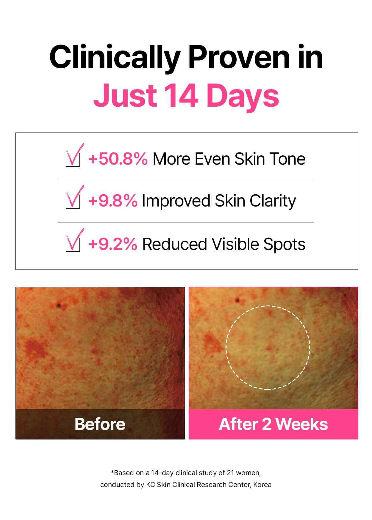 Snp PDRN Gesichtswasser mit 99 % Glutathion und Niacinamid, Behandlung von Hautunreinheiten, Peeling-Pad, LHA, PHA Akne-Pad, Bambus & Vitamin C, E, Ferulasäure, doppelseitiges Pflaster, Toner-Pads