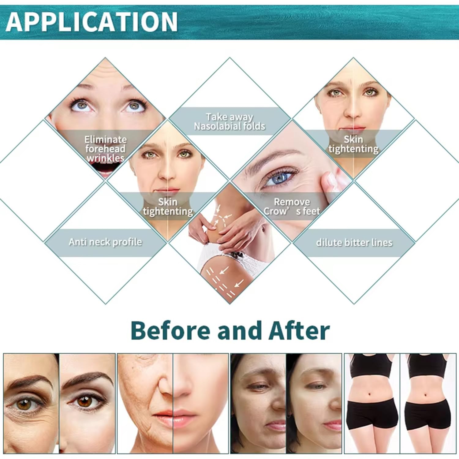 Professionelles Fractional RF Mikronadel-Gerät mit 4 Köpfen & 2 Griffen,Für Facelifting,Faltenreduzierung,Aknenarben-Behandlung & Hautstraffung an Gesicht & Körper