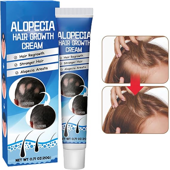 Hair Growth - Liquorice Regrowth Cream for Fast Hair Growth and Hairline Repair | 20g Anti Alopecia Oil with Nourishing Formula, Loss Prevention, Men Women Scalp Care