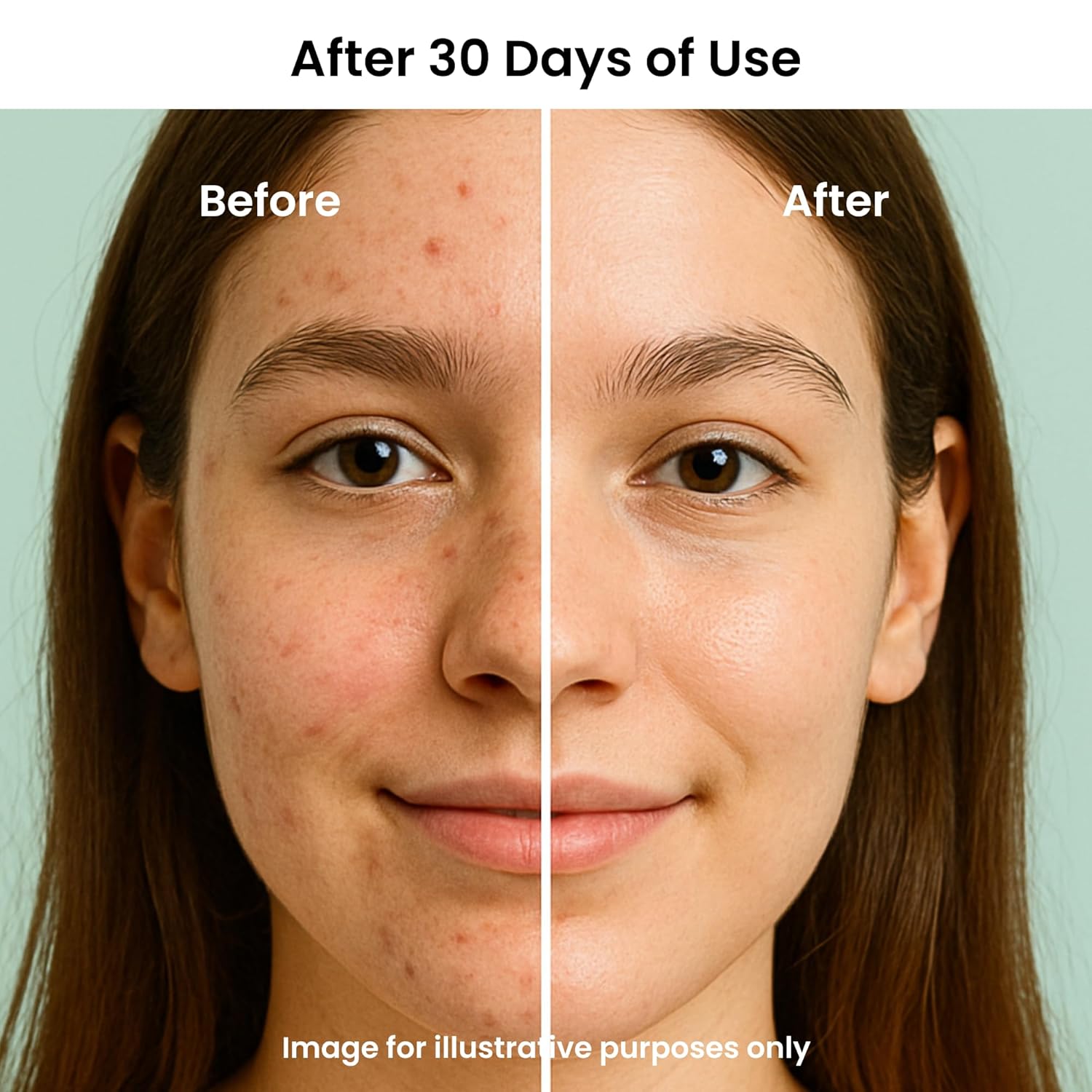 Feat By You ViTassie Forest Energy Vitamin Ampoule Solution - (2.70 fl.oz) Korean Skin Care Serum with Vitamin C, Niacinamide, Hyaluronic Acid, Fast Absorbing, Non-Greasy, Hydrating