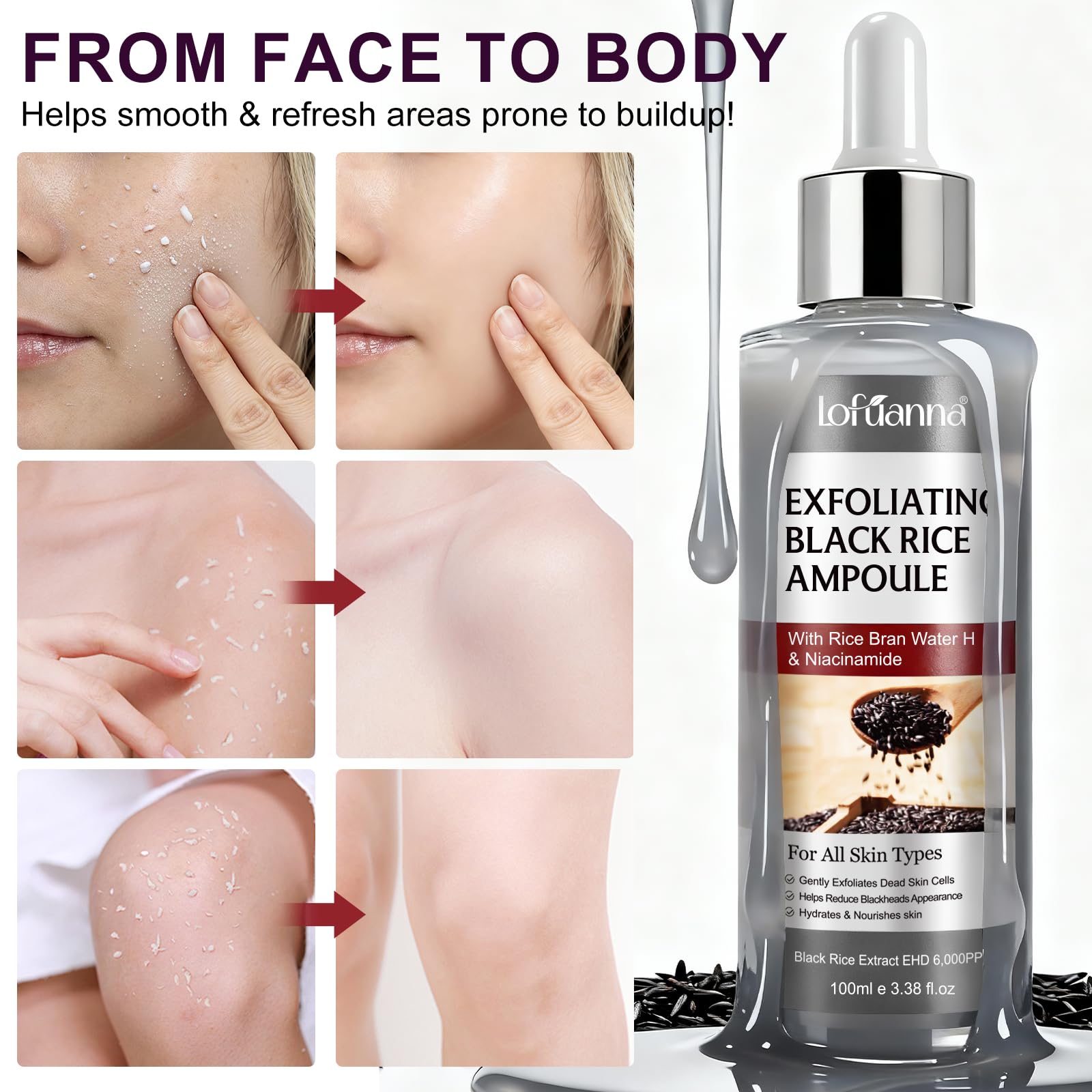 Black Rice Peeling Serum 100ml, Esfoliante Viso Delicato, Siero Esfoliante Riso Nero, Rimuove Cellule Morte e Punti Neri, Minimizza Pori, Niacinamide & Estratto di Riso Nero, Pelle Luminosa e Liscia