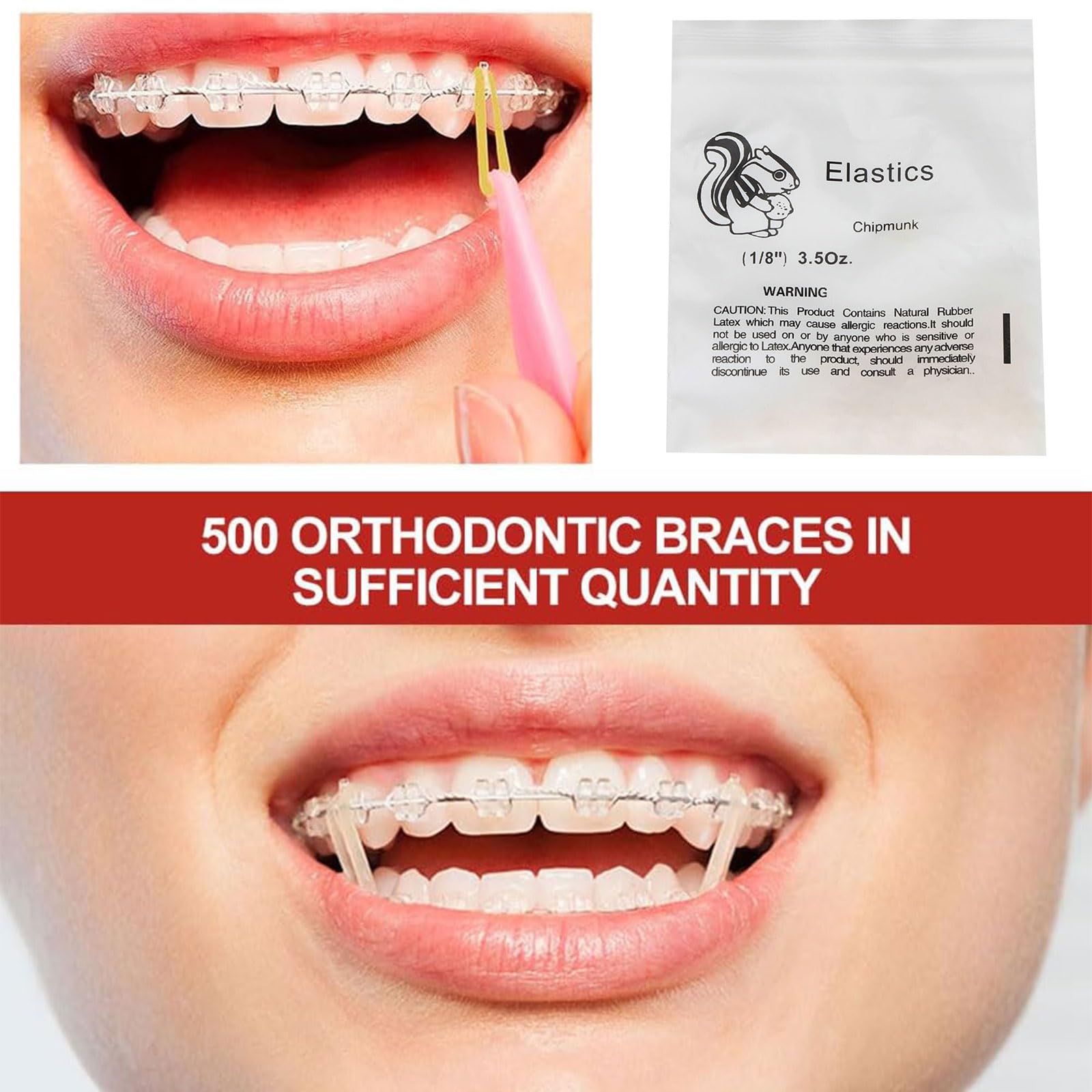 300 Elastici Ortodontici Trasparenti 3/16" - Per Apparecchio Denti, Con Applicatore - Foto 2