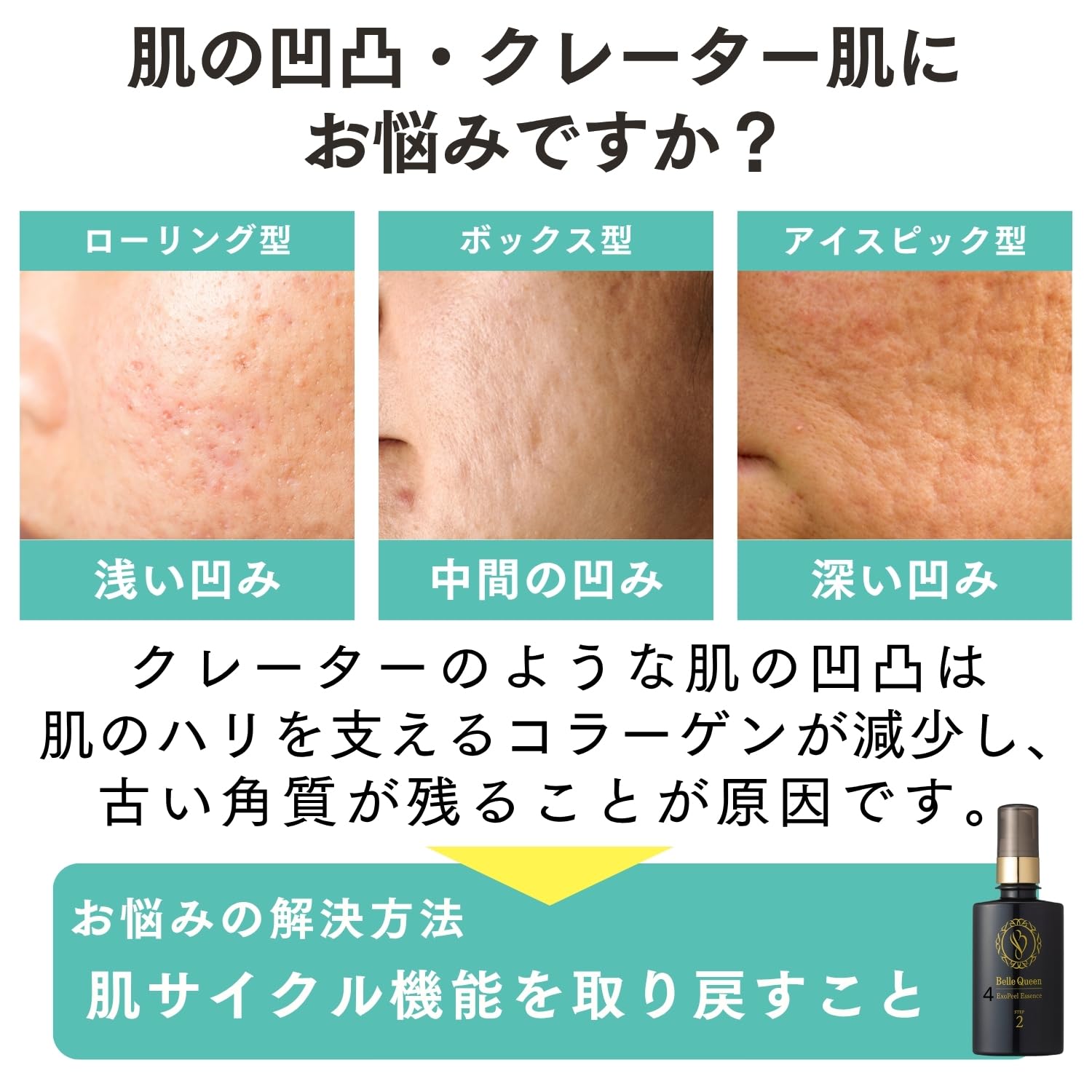 Amazon.co.jp: Dr. Re9 Crater Skin Care Bel Queen Exopeal