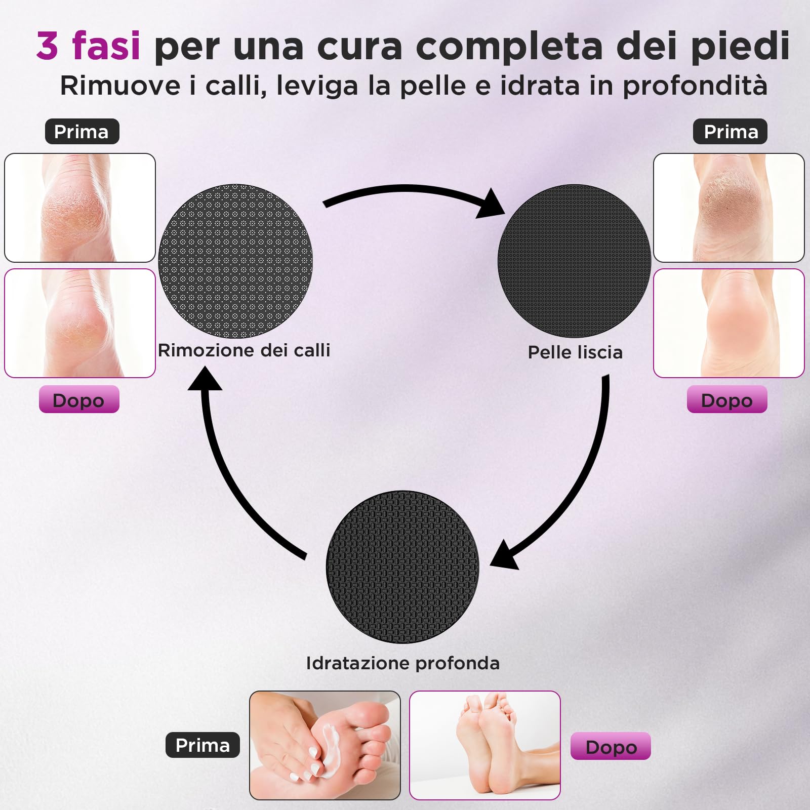 Rimuovi calli elettrico, applicazione di olio, SPA per piedi, lima elettrica per piedi, testina in nano-vetro riutilizzabile, rimuovi calli ergonomico per piedi, strumenti per pedicure ricaricabili