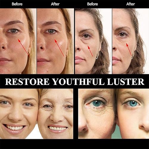 Miniatura 7 de Crema de ojos reafirmante de 1.06oz para quitar instantáneamente, bolsas de ojos, gel antihinchazón, ojeras, desvanecimiento, arrugas, crema