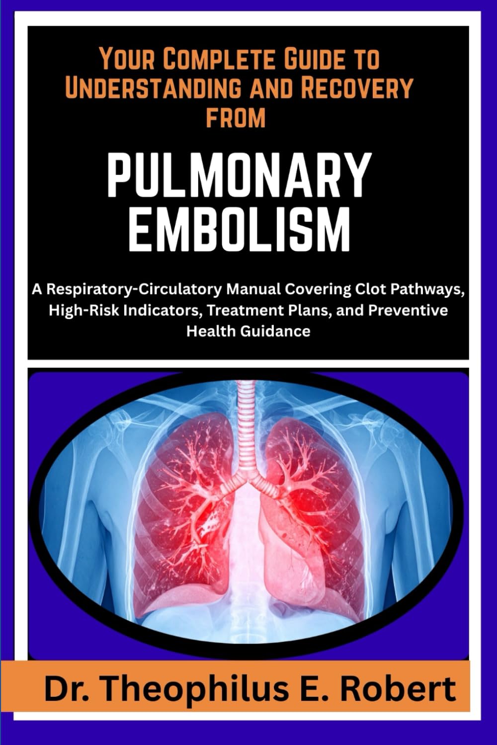YOUR COMPLETE GUIDE TO UNDERSTANDING AND RECOVERY FROM PULMONARY EMBOLISM: A Respiratory-Circulatory Manual Covering Clot Pathways, High-Risk ... Plans, and Preventive Health Guidance