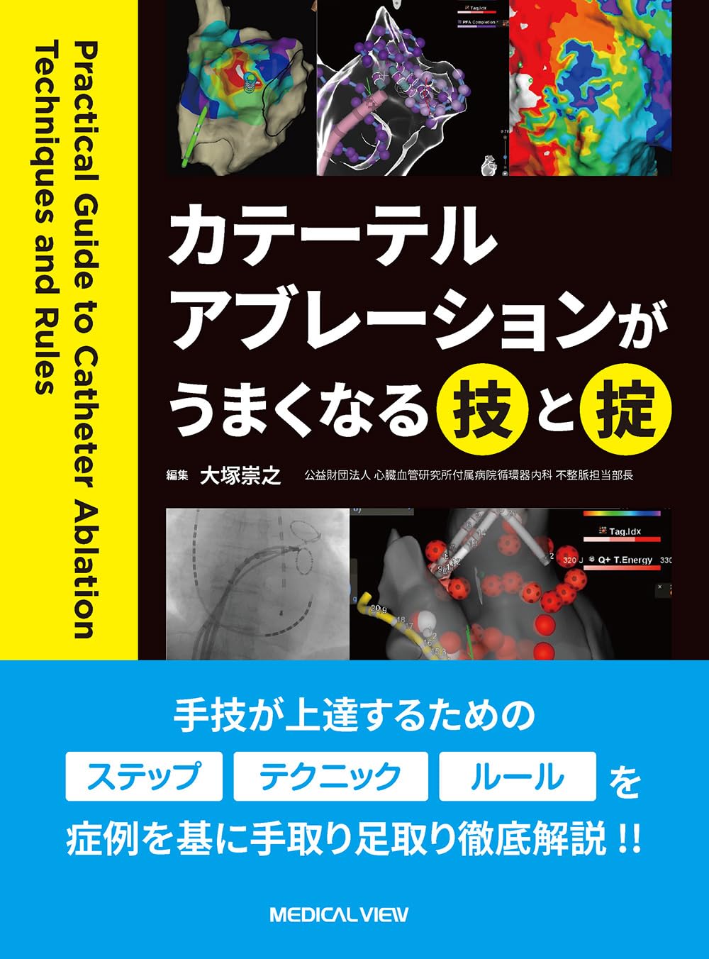 カテーテルアブレーションがうまくなる技と掟 | 大塚 崇之 |本 | 通販