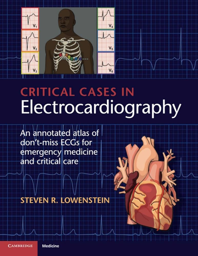 Critical Cases in Electrocardiography: An Annotated Atlas of Don't