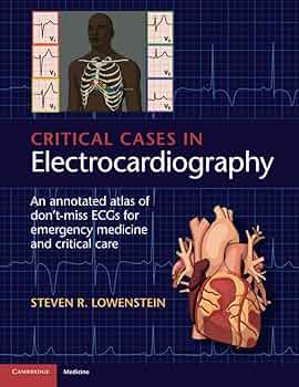 Critical Cases in Electrocardiography: An Annotated Atlas of Don't