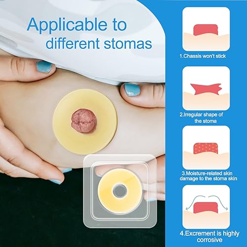 Miniatura 5 de 10 anillos de barrera para ostomía – 0.079 pulgadas de grosor hidrocoloide de grado médico, anillos extensores moldeables para la prevención